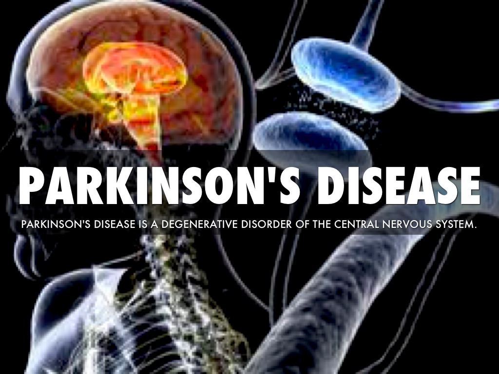 After the diagnosis: Living with Parkinson’s