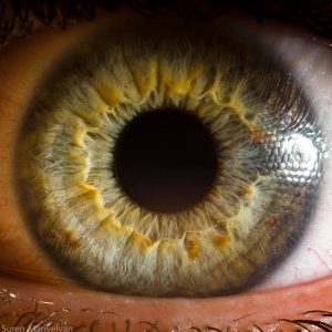 YOUR EYES MAY REAVEL YOUR TRUE BIOLOGICAL AGE